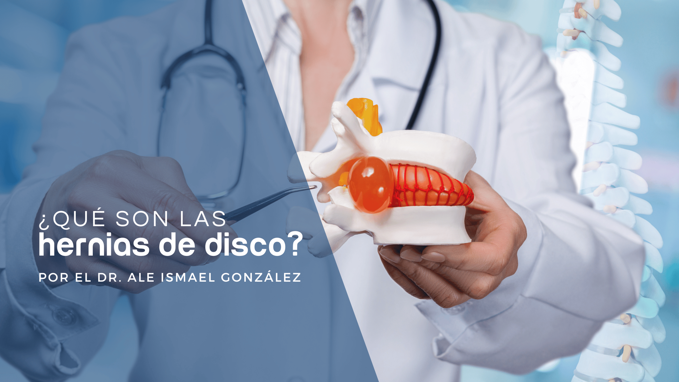 hernias-de-disco