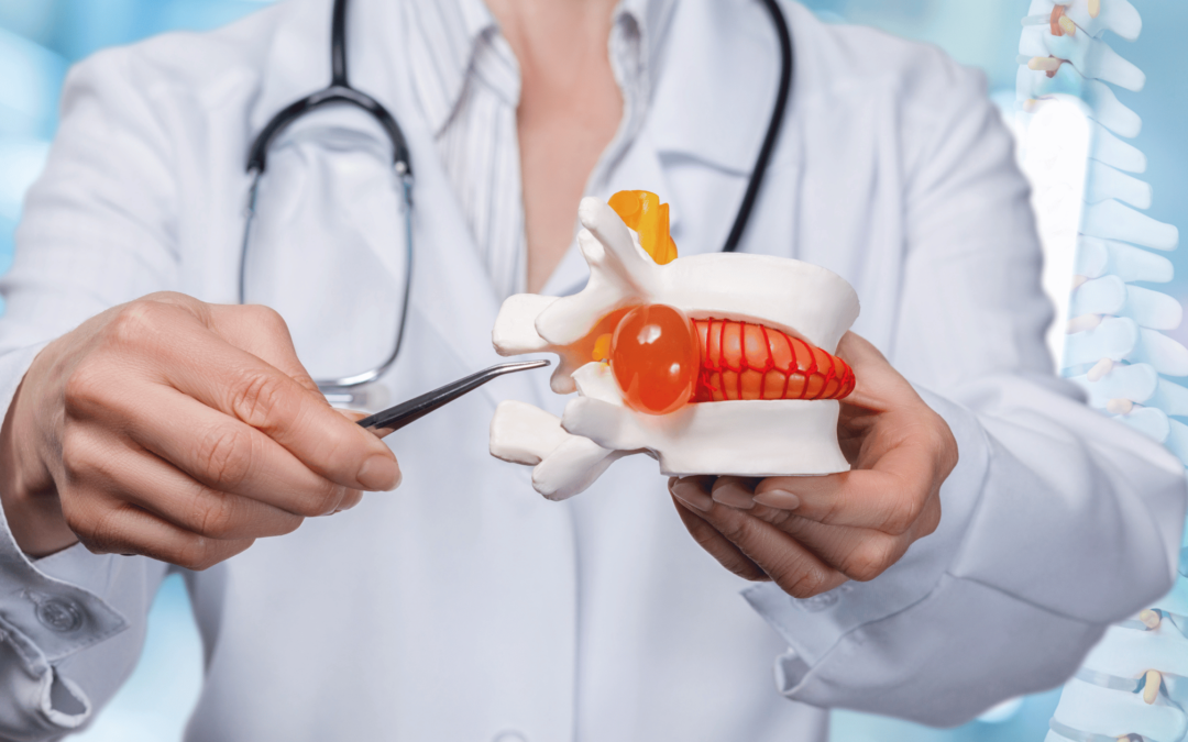 ¿Qué son las Hernias de Disco?