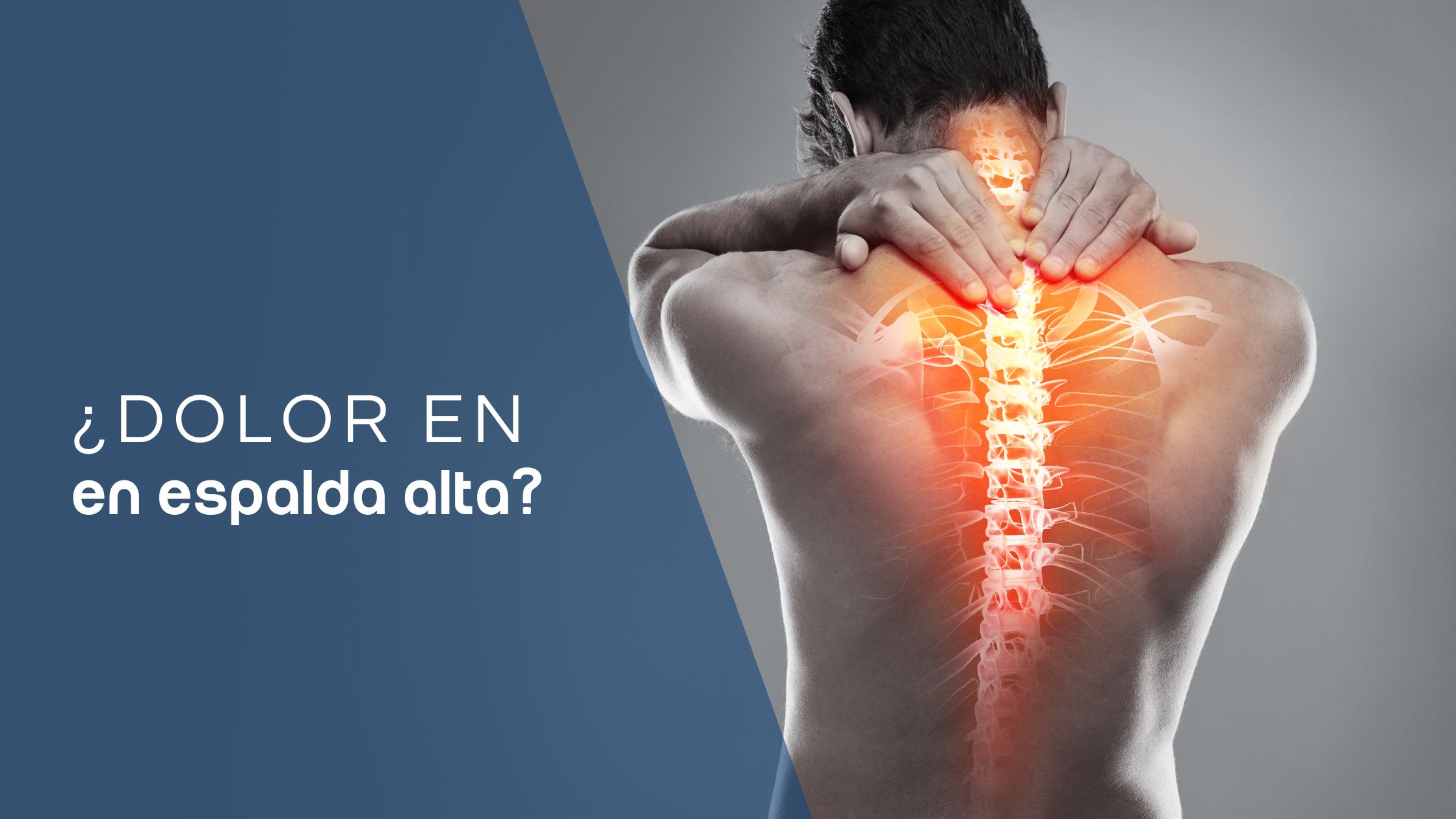 dolor de espalda alta
