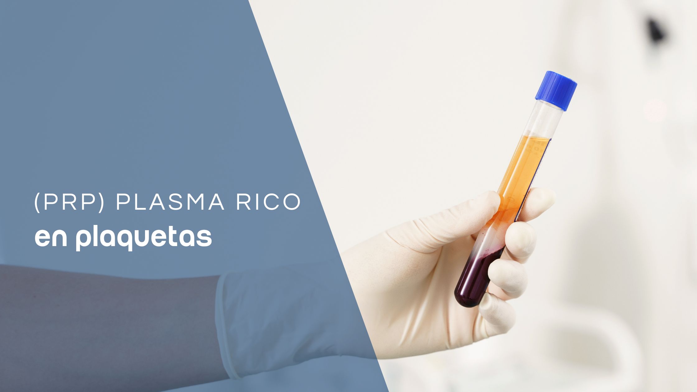 prp plassma rico en plaquetas