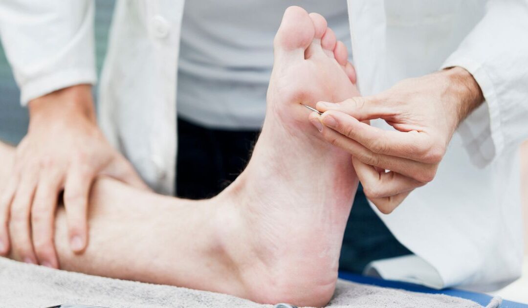 Especialista en Neuropatía Diabética