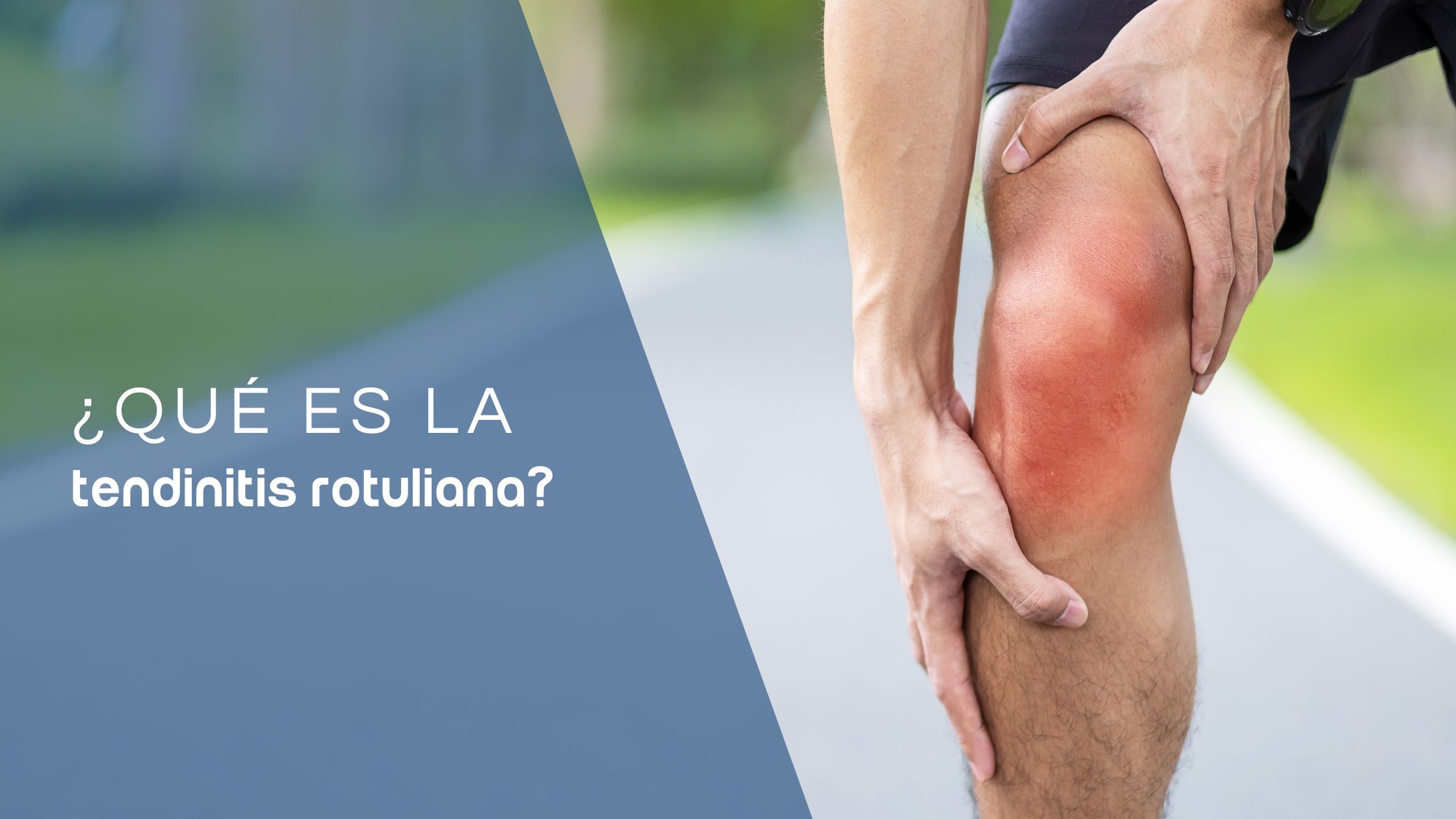 tendinitis rotuliana