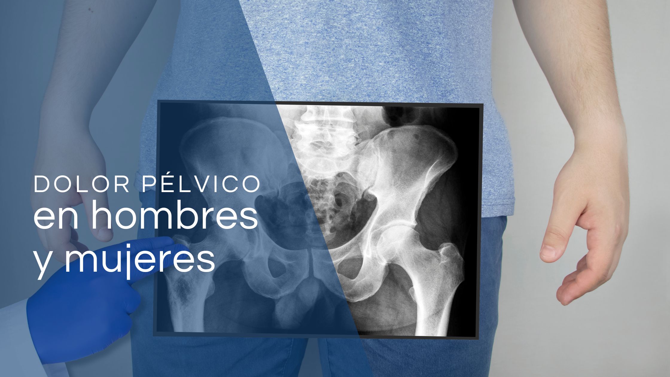 dolor pélvico crónico en hombres y mujeres