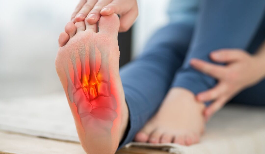 Todo lo que Debes Saber sobre la Fascitis Plantar