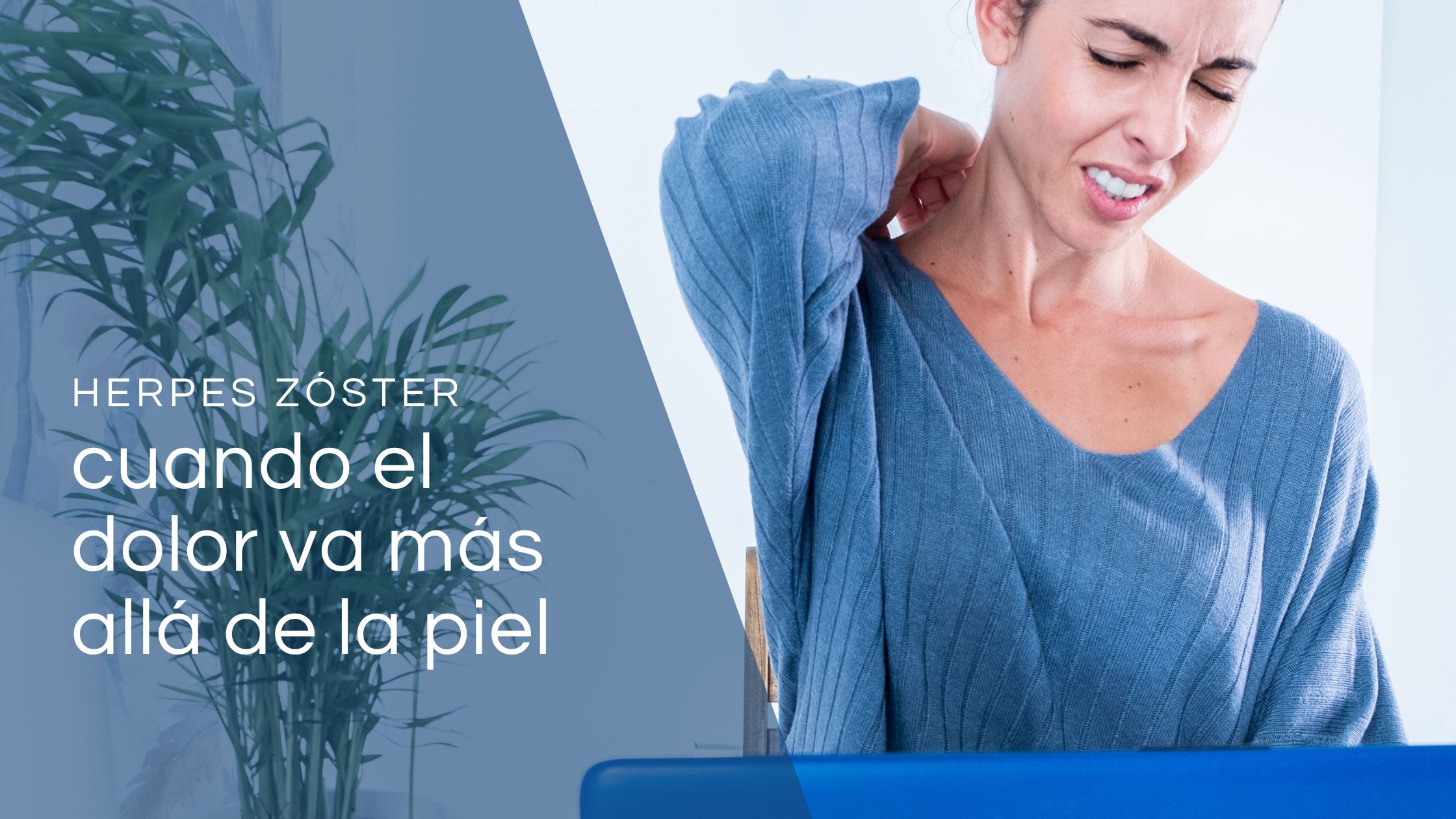 Herpes Zóster_ cuando el dolor va más allá de la piel
